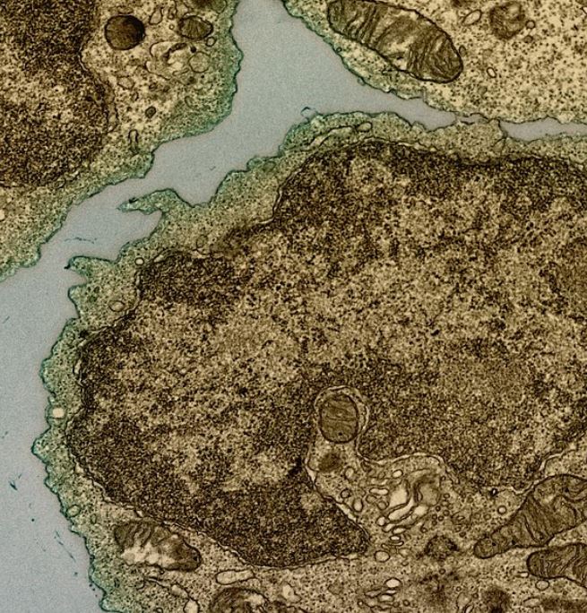 Επιστήμονες αποκαλύπτουν: Πώς ιοί εκατομμυρίων ετών καταπολεμούν τον καρκίνο